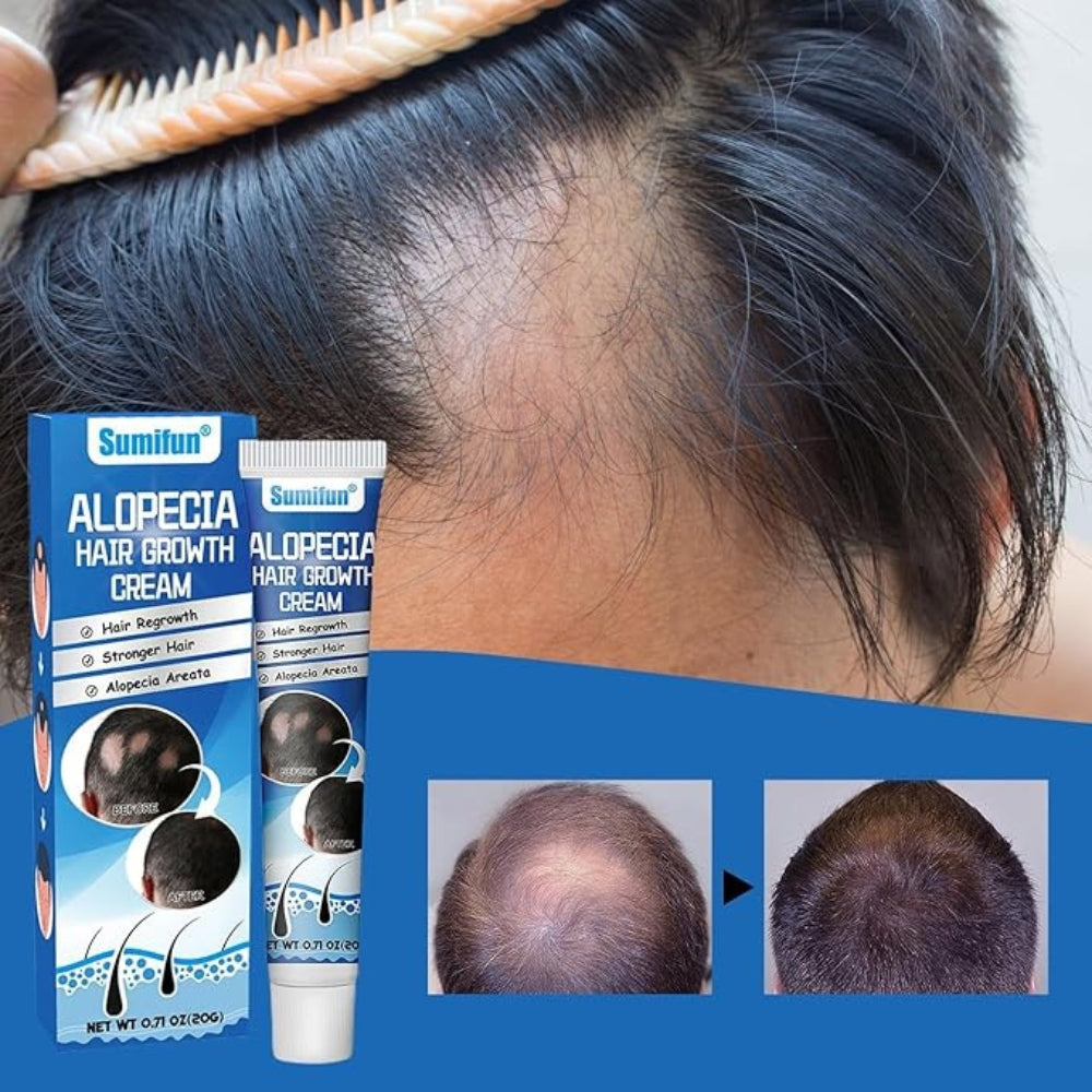 HAIR GROWTH CREAM (20G)