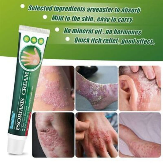 SUMMIFUN PSORIASIS CREAM (ORIGINAL)